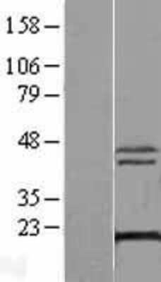 Western Blot XTP3TPA Overexpression Lysate