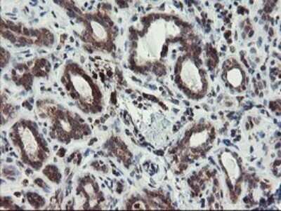 Immunohistochemistry: XTP4 Antibody (OTI2D5) - Azide and BSA Free [NBP2-74904] - Analysis of Human breast tissue.
