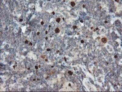 Immunohistochemistry: XTP4 Antibody (OTI2D5) - Azide and BSA Free [NBP2-74904] - Analysis of Human lymphoma tissue.