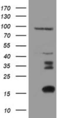 Western Blot: XTP4 Antibody (OTI2D5) - Azide and BSA Free [NBP2-74904] - Analysis of HEK293T cells were transfected with the pCMV6-ENTRY control (Left lane) or pCMV6-ENTRY XTP4.