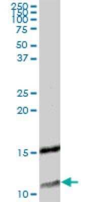 Western Blot: XTP4 Antibody [H00084299-B01P] - C17orf37 MaxPab polyclonal antibody. Western Blot analysis of C17orf37 expression in human colon.