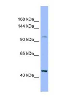 Western Blot XYLT2 Antibody