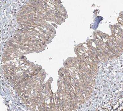 Immunohistochemistry-Paraffin: Xrn1 Antibody [NBP1-89419] - Staining of human urinary bladder shows weak cytoplasmic positivity in urothelial cells.