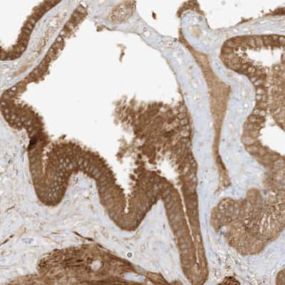 Immunohistochemistry-Paraffin Xrn1 Antibody