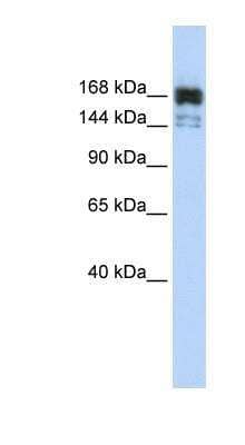 Western Blot: Xrn1 Antibody [NBP1-57281] - MCF-7 whole cell lysates, concentration 0.2-1 ug/ml.