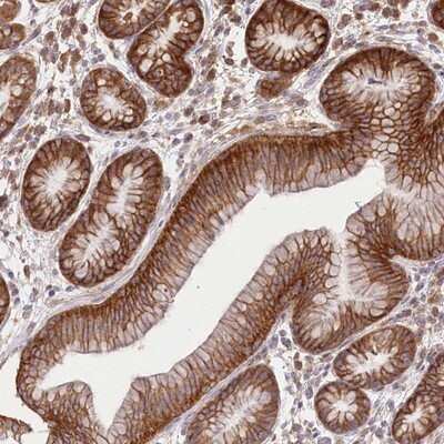 Immunohistochemistry-Paraffin: Xylulokinase/XYLB Antibody [NBP1-87919] - Staining of human stomach shows strong cytoplasmic and membrane positivity in glandular cells.