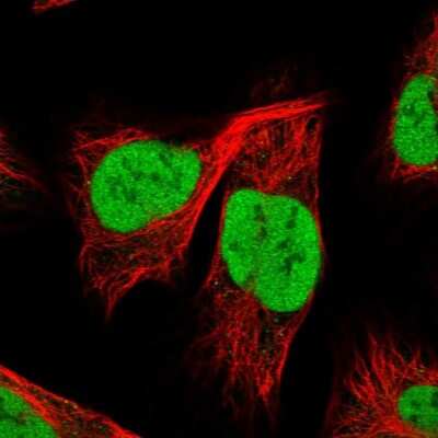 Immunocytochemistry/ Immunofluorescence YAF2 Antibody