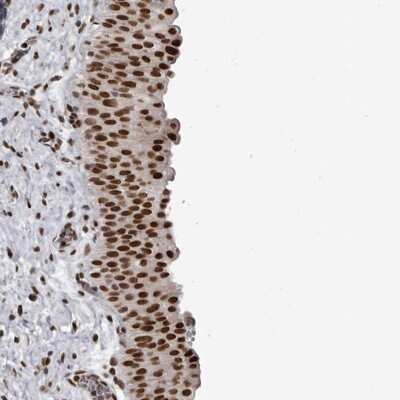 Immunohistochemistry-Paraffin: YAF2 Antibody [NBP1-89444] - Staining of human urinary bladder shows strong nuclear positivity in urothelial cells.