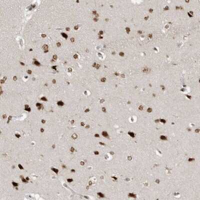 Immunohistochemistry-Paraffin YAF2 Antibody