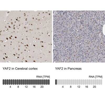 Immunohistochemistry-Paraffin YAF2 Antibody