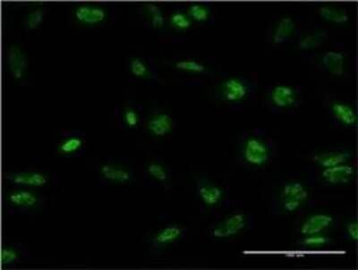 Immunocytochemistry/ Immunofluorescence YANK2 Antibody (4A7)