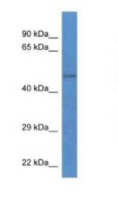 Western Blot: YANK2 Antibody [NBP1-74225] - Titration: 1.0 ug/ml Positive Control: Mouse Brain.