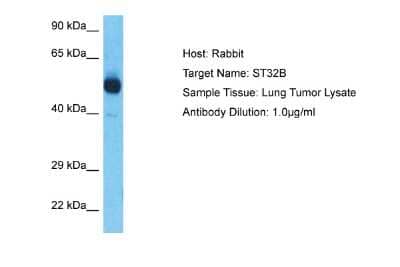 Western Blot: YANK2 Antibody [NBP3-09350] - Western blot analysis of YANK2 in Lung Tumor lysates. Antibody dilution at 1.0ug/ml