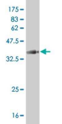 Western Blot: YAP1 Antibody (2C2) - Isoform 5 [H00010413-M02] - Immunogen detection using YAP1 antibody (2C2) Isoform 5, observered MW 37.73KDa) .