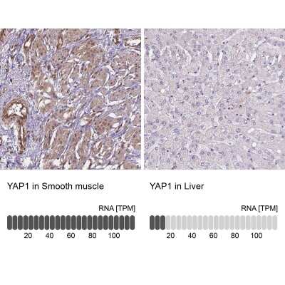 Immunohistochemistry-Paraffin: YAP1 Antibody [NBP2-62669] - Analysis in human smooth muscle and liver tissues using Anti-YAP1 antibody. Corresponding YAP1 RNA-seq data are presented for the same tissues. Dilution: 1:1000 - 1:2500.