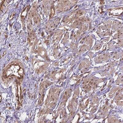 Immunohistochemistry-Paraffin: YAP1 Antibody [NBP2-62669] - Staining of human smooth muscle shows high expression. Dilution: 1:1000 - 1:2500.