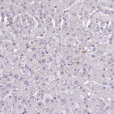 Immunohistochemistry-Paraffin: YAP1 Antibody [NBP2-62669] - Staining of human liver shows low expression as expected. Dilution: 1:1000 - 1:2500.