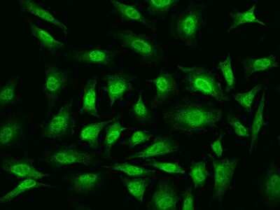Immunocytochemistry/Immunofluorescence: YB1 Antibody [NBP2-98908] - Immunofluorescence staining of YB1 in HeLa cells. Cells were fixed with 4% PFA, permeabilzed with 0.1% Triton X-100 in PBS, blocked with 10% serum, and incubated with rabbit anti-Human YB1 polyclonal antibody (dilution ratio 1:200) at 4C overnight. Then cells were stained with the Alexa Fluor(R)488-conjugated Goat Anti-rabbit IgG secondary antibody (green). Positive staining was localized to Nucleus and Cytoplasm.