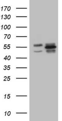 Western Blot: YB1 Antibody (OTI7B4) - Azide and BSA Free [NBP2-74905] - Analysis of HEK293T cells were transfected with the pCMV6-ENTRY control (Left lane) or pCMV6-ENTRY YB1.