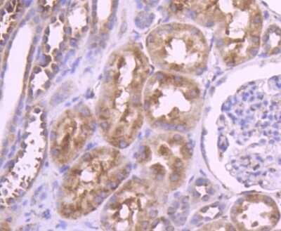 Immunohistochemistry-Paraffin: YB1 Antibody (ST0432) [NBP2-67491] - Analysis of paraffin-embedded human kidney tissue using anti-YB1 antibody. Counter stained with hematoxylin.