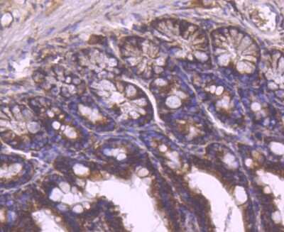 Immunohistochemistry-Paraffin: YB1 Antibody (ST0432) [NBP2-67491] - Anaysis of paraffin-embedded mouse colon tissue using anti-YB1 antibody. Counter stained with hematoxylin.