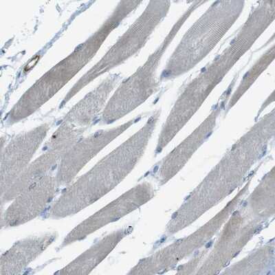 Immunohistochemistry-Paraffin YIF1A Antibody - BSA Free
