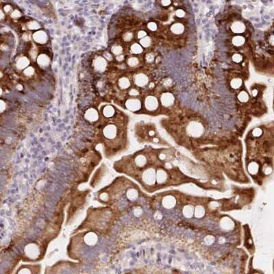 Immunohistochemistry-Paraffin: YIF1B Antibody [NBP2-49179] - Staining of human small intestine shows strong cytoplasmic positivity in glandular cells.