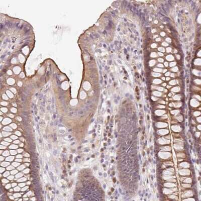 Immunohistochemistry-Paraffin: YIF1B Antibody [NBP2-57630] - Immunohistochemical staining of human colon shows moderate cytoplasmic and membranous positivity in glandular cells.