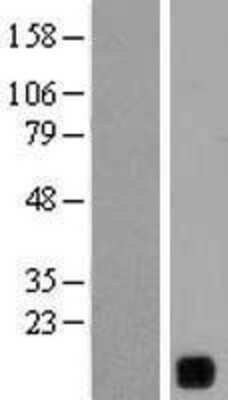 Western Blot: YIF1B Overexpression Lysate (Adult Normal) [NBL1-12616] Left-Empty vector transfected control cell lysate (HEK293 cell lysate); Right -Over-expression Lysate for YIF1B.