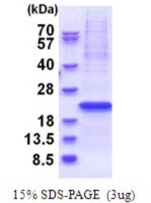SDS-PAGE Recombinant Human YIF1B His Protein