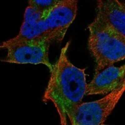 Immunocytochemistry/Immunofluorescence: YIPF1 Antibody [NBP3-17560] - Staining of human cell line SK-MEL-30 shows localization to nucleoplasm, plasma membrane & the Golgi apparatus.