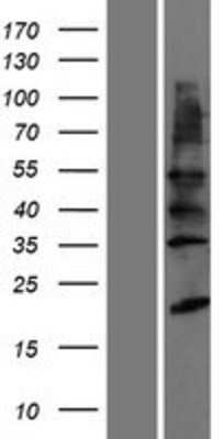 Western Blot: YIPF2 Overexpression Lysate (Adult Normal) [NBP2-06363] Left-Empty vector transfected control cell lysate (HEK293 cell lysate); Right -Over-expression Lysate for YIPF2.