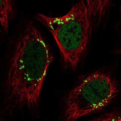 Immunocytochemistry/Immunofluorescence: YIPF3 Antibody [NBP2-56181] - Staining of human cell line U-2 OS shows localization to nucleoplasm & the Golgi apparatus.