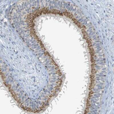 Immunohistochemistry-Paraffin: YIPF3 Antibody [NBP1-86765] - Staining of human epididymis shows cytoplasmic positivity in glandular cells.