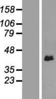 Western Blot YIPF3 Overexpression Lysate