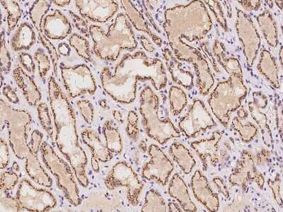 Immunohistochemistry-Paraffin: YIPF4 Antibody [NBP2-97649] - Immunochemical staining of human YIPF4 in human kidney with rabbit polyclonal antibody at 1:100 dilution, formalin-fixed paraffin embedded sections.