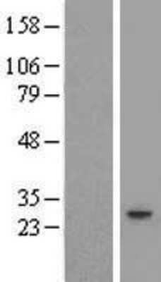 Western Blot YIPF4 Overexpression Lysate