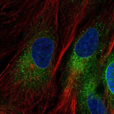 Immunocytochemistry/Immunofluorescence: YIPF5 Antibody [NBP2-57970] - Staining of human cell line BJ shows localization to endoplasmic reticulum & vesicles. Antibody staining is shown in green.
