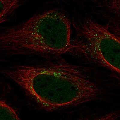 Immunocytochemistry/ Immunofluorescence YIPF5 Antibody - BSA Free