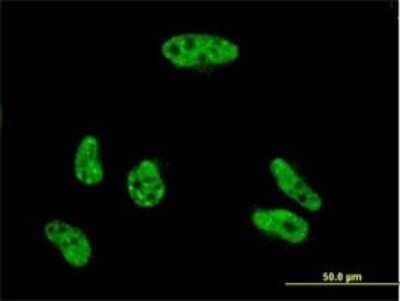 Immunocytochemistry/Immunofluorescence: YL1 Antibody (2G6) [H00006944-M01] - Analysis of monoclonal antibody to VPS72 on HeLa cell . Antibody concentration 10 ug/ml.