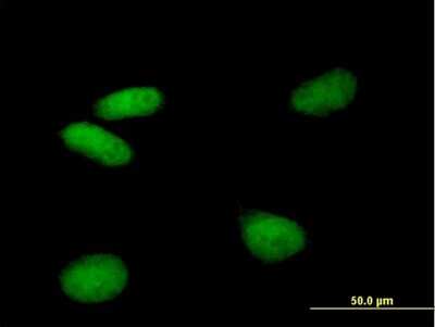 Immunocytochemistry/Immunofluorescence: YL1 Antibody [H00006944-B01P] - Analysis of purified antibody to VPS72 on HeLa cell. (antibody concentration 10 ug/ml)