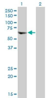 Western Blot: YL1 Antibody [H00006944-D01P] - Analysis of VPS72 expression in transfected 293T cell line by VPS72 polyclonal antibody.Lane 1: VPS72 transfected lysate(40.60 KDa).Lane 2: Non-transfected lysate.