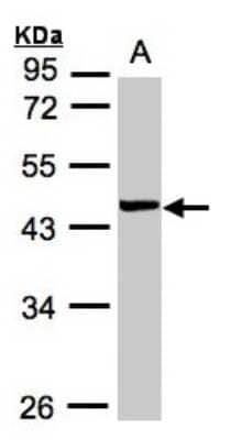 Western Blot: YL1 Antibody [NBP1-32503] - Sample(30 ug whole cell lysate)A:MOLT4  10% SDS PAGE, antibody diluted at 1:1000.