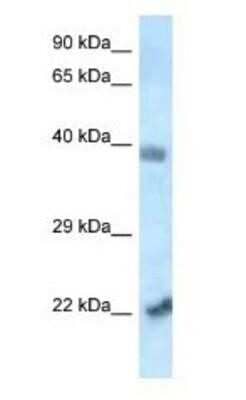 Western Blot: YL1 Antibody [NBP1-82385] - Mouse Heart Lysate 1.0 ug/ml, gel concentration 12%
