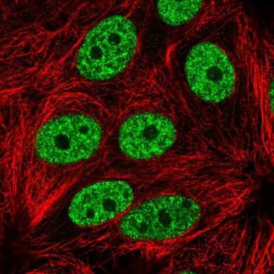 Immunocytochemistry/ Immunofluorescence YLPM1 Antibody - BSA Free