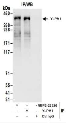 Immunoprecipitation YLPM1 Antibody - BSA Free