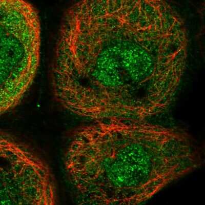 Immunocytochemistry/ Immunofluorescence YOD1 Antibody - BSA Free