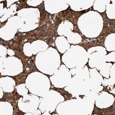 Immunohistochemistry-Paraffin: YOD1 Antibody [NBP1-84173] - Staining of human bone marrow shows cytoplasmic positivity in hematopoietic cells.