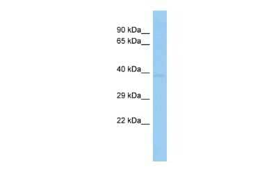 Western Blot: YOD1 Antibody [NBP2-88598] - Host: Rabbit. Target Name: YOD1. Sample Type: Placenta lysates. Antibody Dilution: 1.0ug/ml