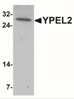 Western Blot YPEL2 Antibody - BSA Free